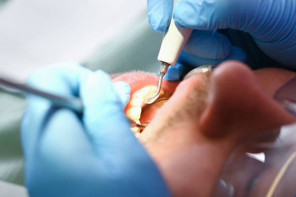 Best Dental Abscess Treatment in Castroville, TX