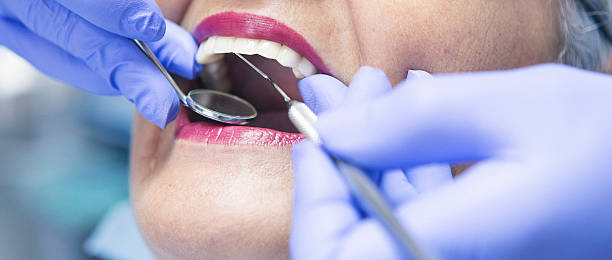Best Walk-In Emergency Dental Services in Castroville, TX